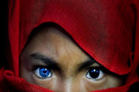 Hal Aneh yang Terjadi pada Tubuh Manusia